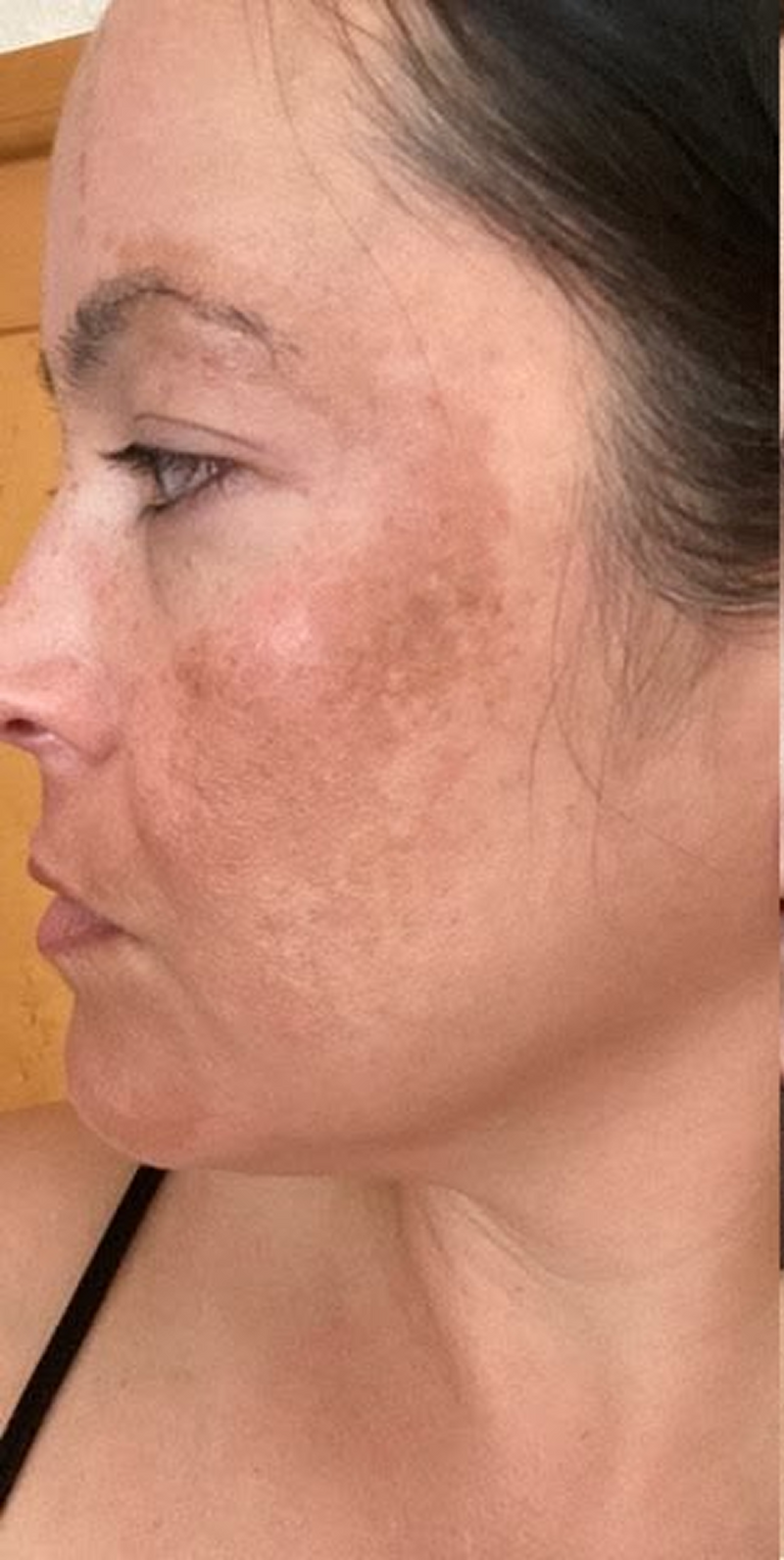 Glowing Skin In Weeks