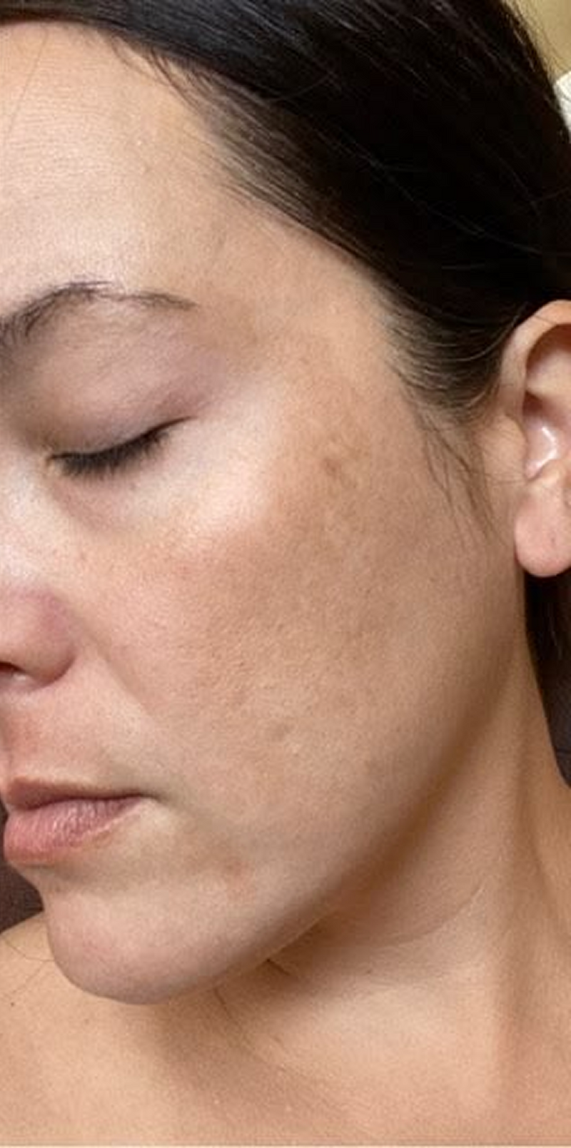 Glowing Skin In Weeks