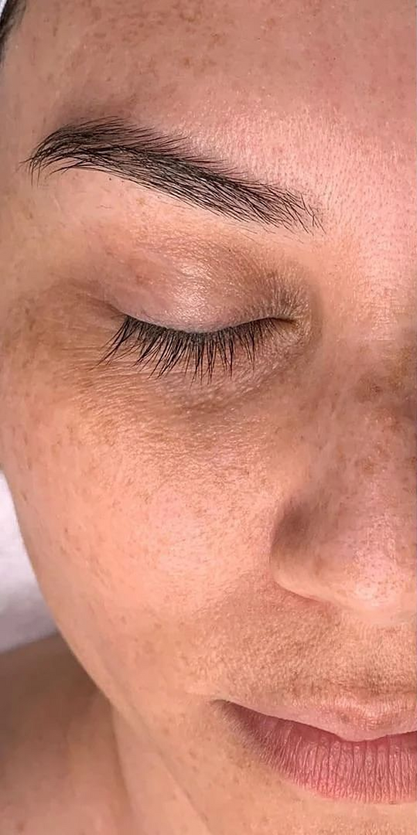 Sculpted Skin in Minutes